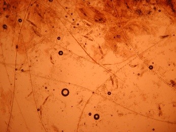 Demodex canis